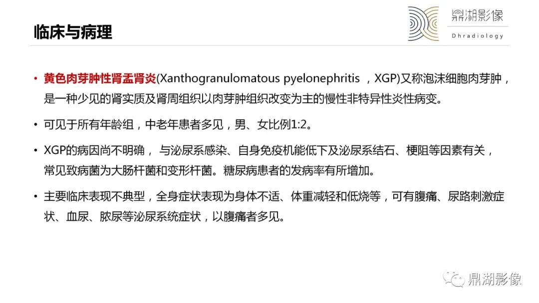 影像PPT - 【PPT】黄色肉芽肿性肾盂肾炎-10 影像PPT - 【PPT】黄色肉芽肿性肾盂肾炎-10