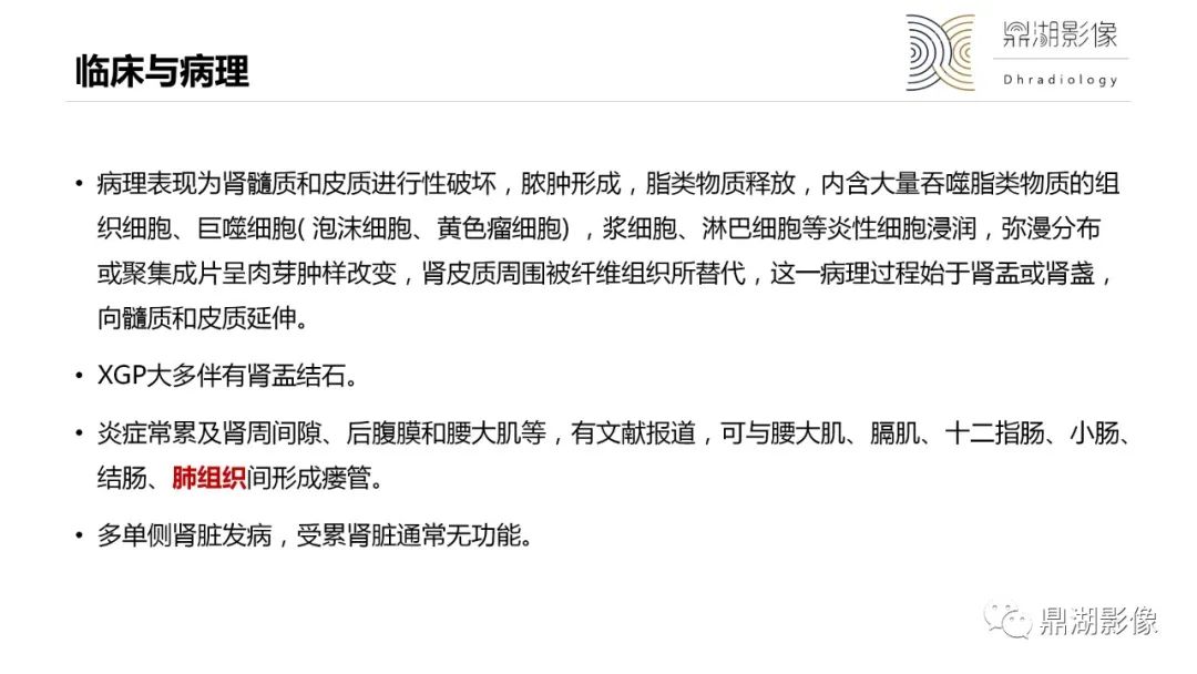 影像PPT - 【PPT】黄色肉芽肿性肾盂肾炎-11 影像PPT - 【PPT】黄色肉芽肿性肾盂肾炎-11