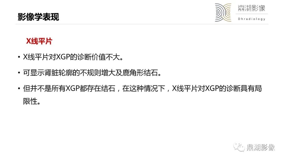影像PPT - 【PPT】黄色肉芽肿性肾盂肾炎-13 影像PPT - 【PPT】黄色肉芽肿性肾盂肾炎-13