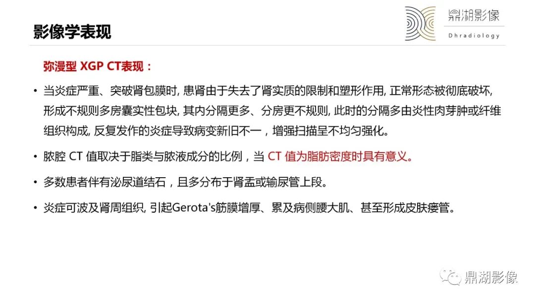 影像PPT - 【PPT】黄色肉芽肿性肾盂肾炎-17 影像PPT - 【PPT】黄色肉芽肿性肾盂肾炎-17