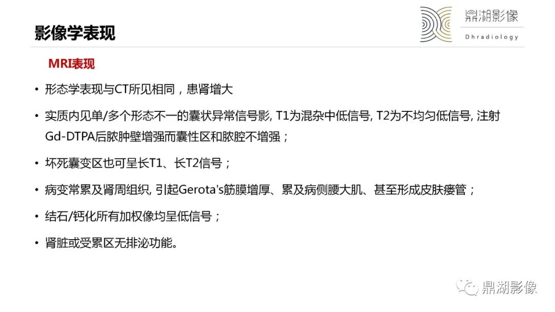影像PPT - 【PPT】黄色肉芽肿性肾盂肾炎-25 影像PPT - 【PPT】黄色肉芽肿性肾盂肾炎-25