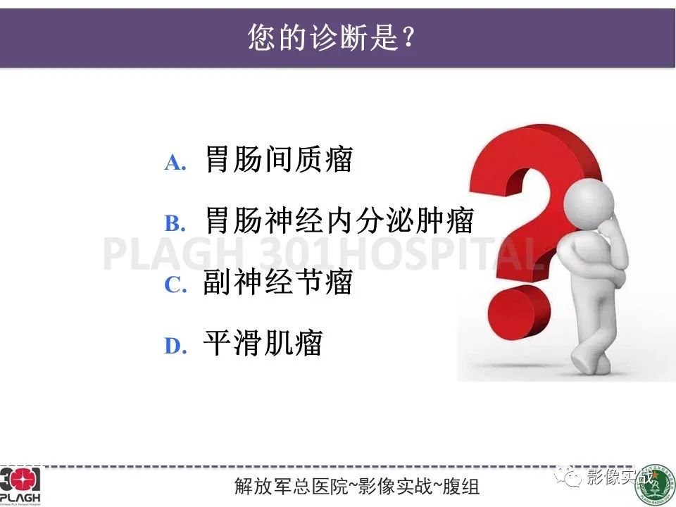 影像PPT - 【病例】小肠间质瘤1例CT影像-10