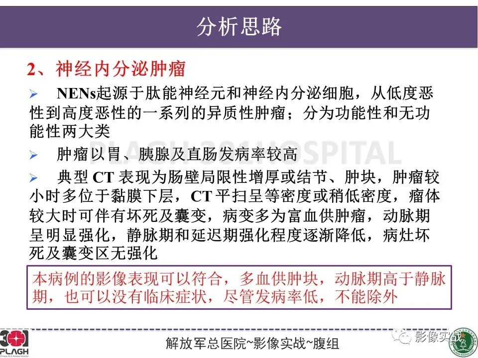 影像PPT - 【病例】小肠间质瘤1例CT影像-14