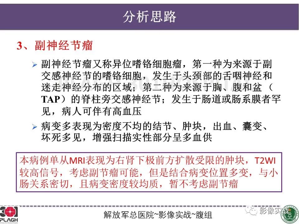 影像PPT - 【病例】小肠间质瘤1例CT影像-15