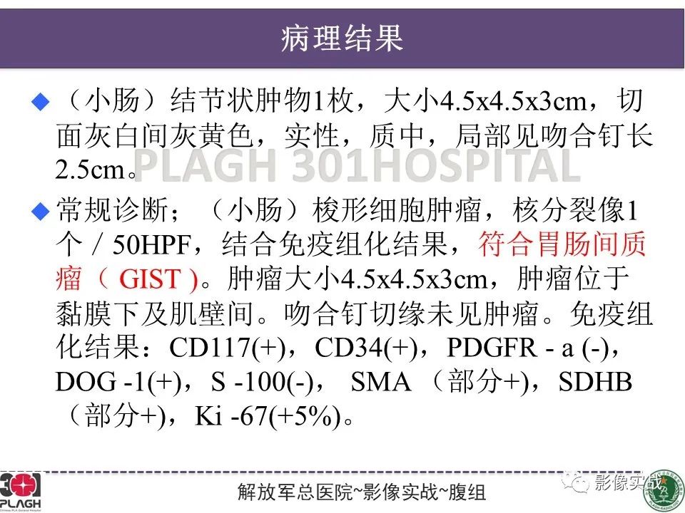 影像PPT - 【病例】小肠间质瘤1例CT影像-18