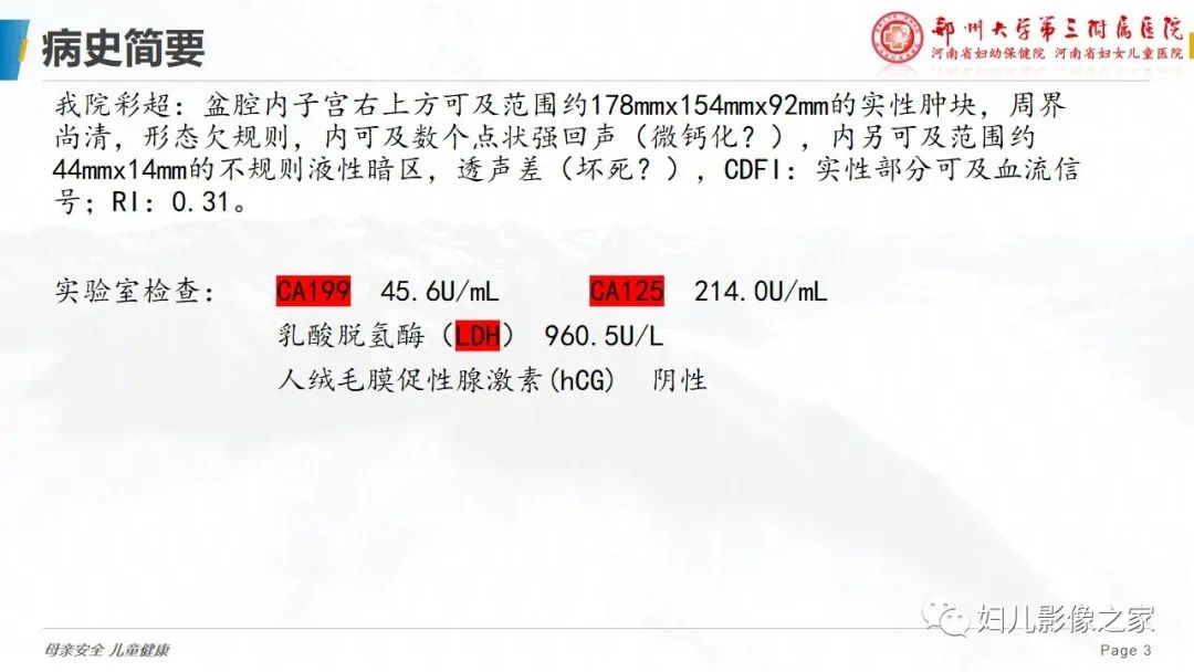 影像PPT - 【病例】卵巢无性细胞瘤1例CT及MR影像-3