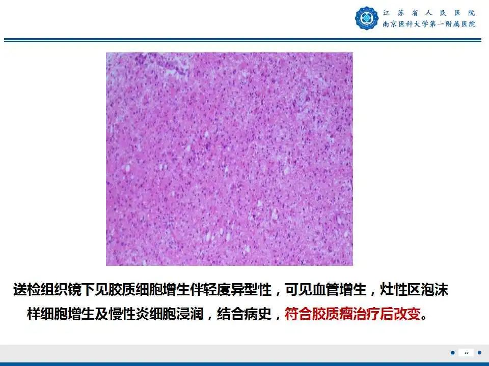 影像PPT - 【PPT】胶质瘤术后复发-40