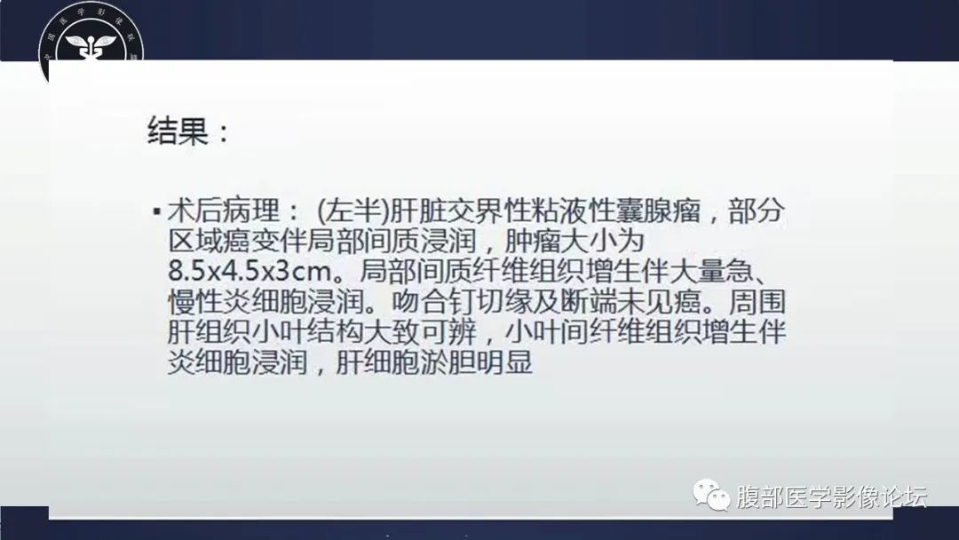 影像PPT - 【病例】肝脏交界性粘液性囊腺瘤1例CT及MR影像-6