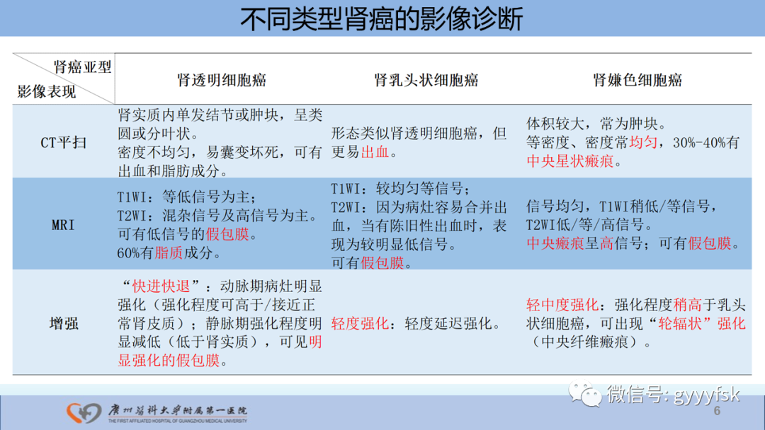 影像PPT - 【PPT】肾癌相关影像诊断的文献汇报-6