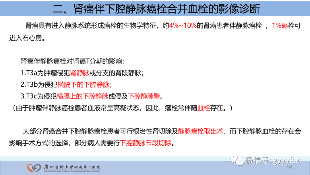影像PPT - 【PPT】肾癌相关影像诊断的文献汇报-14