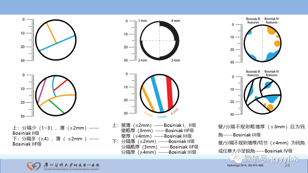 影像PPT - 【PPT】肾癌相关影像诊断的文献汇报-24