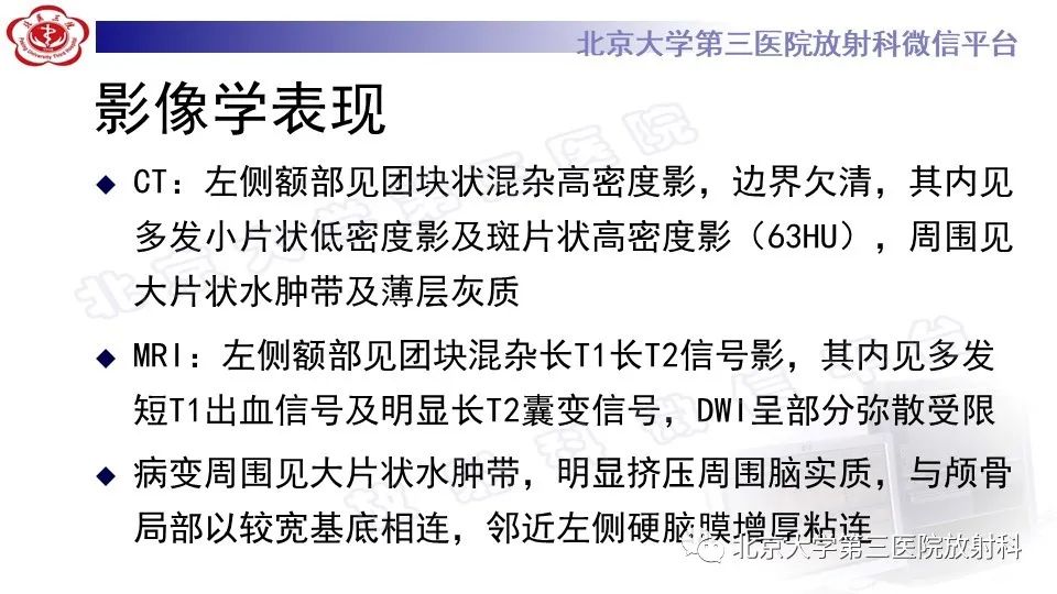 影像PPT - 【PPT】间变性脑膜瘤-7