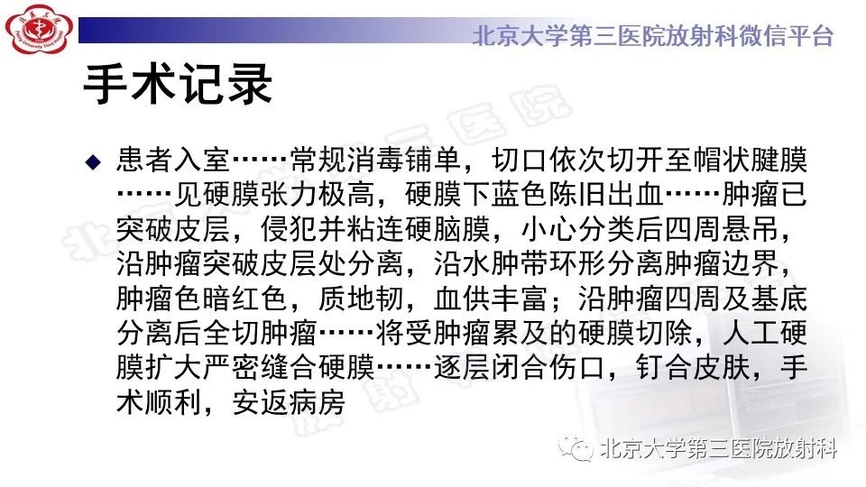 影像PPT - 【PPT】间变性脑膜瘤-9