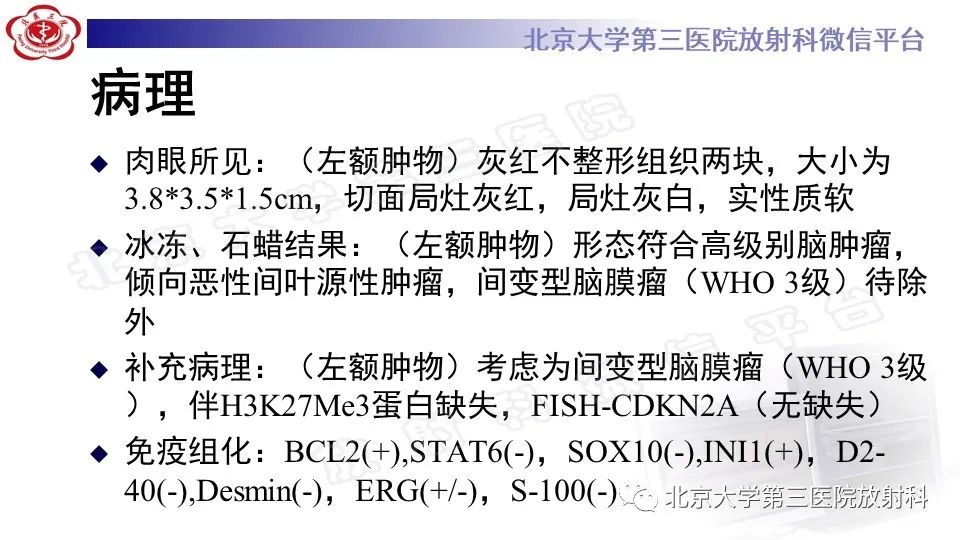 影像PPT - 【PPT】间变性脑膜瘤-10