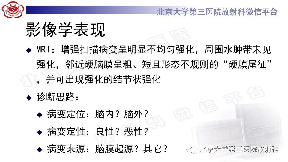 影像PPT - 【PPT】间变性脑膜瘤-8