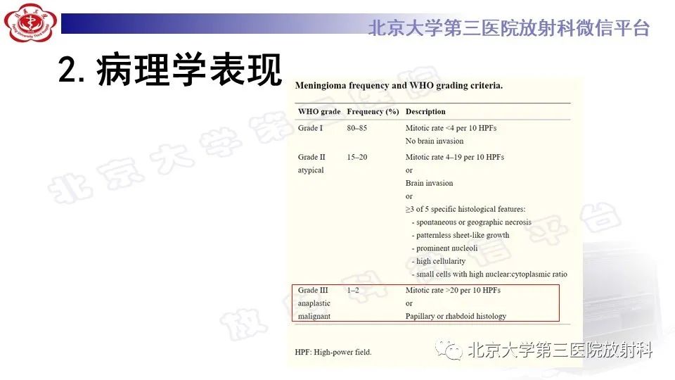 影像PPT - 【PPT】间变性脑膜瘤-15