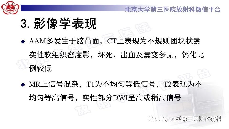 影像PPT - 【PPT】间变性脑膜瘤-16