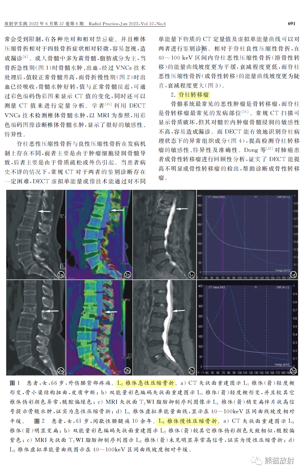 影像PPT - 双能量CT在脊柱病变中的临床应用-2