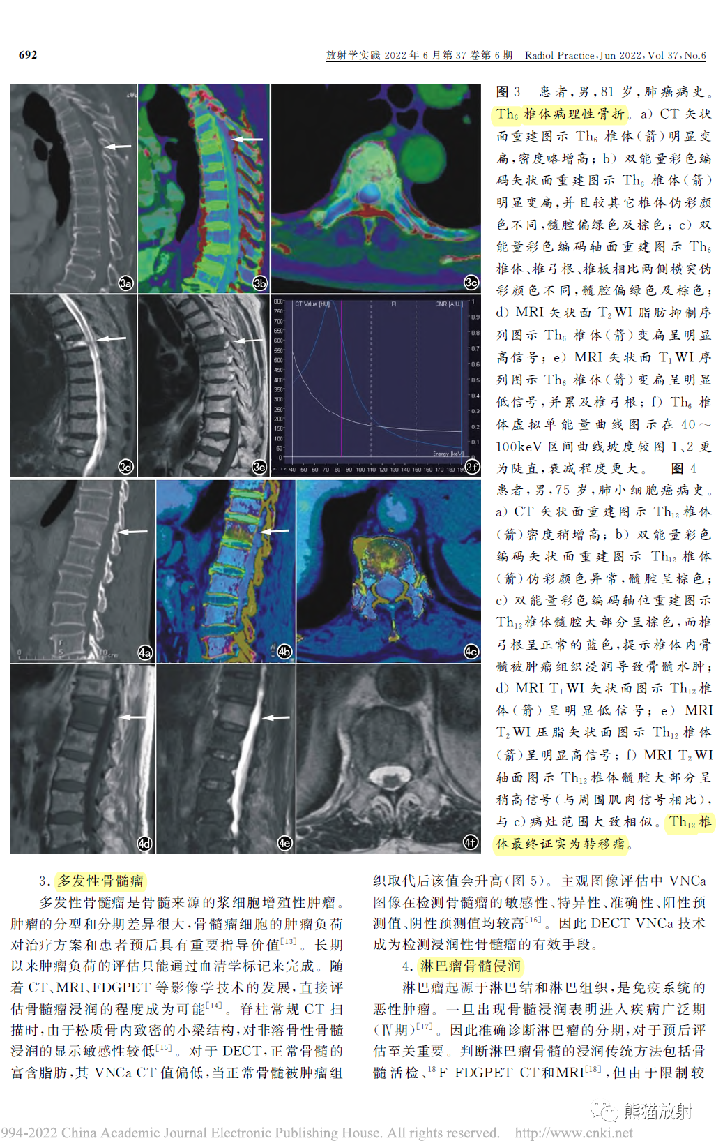 影像PPT - 双能量CT在脊柱病变中的临床应用-3