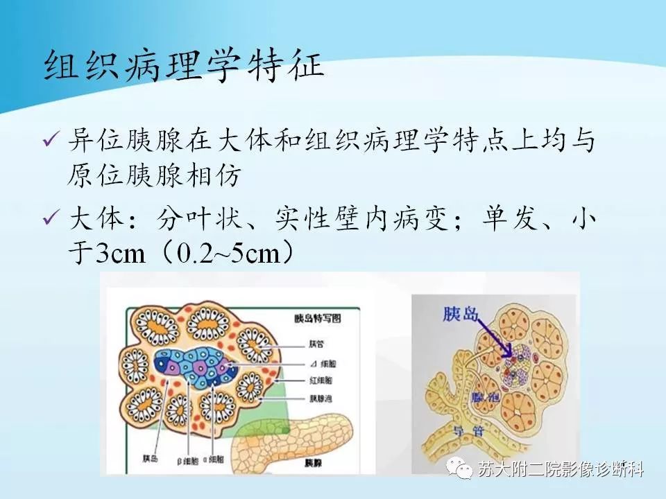 影像PPT - 【PPT】异位胰腺影像学特征及并发症-4