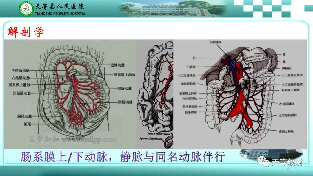 影像PPT - 【PPT】缺血性肠病的影像学表现-2