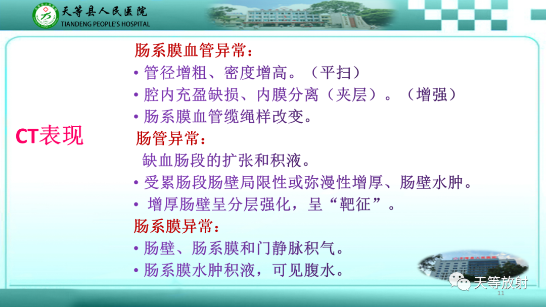 影像PPT - 【PPT】缺血性肠病的影像学表现-10