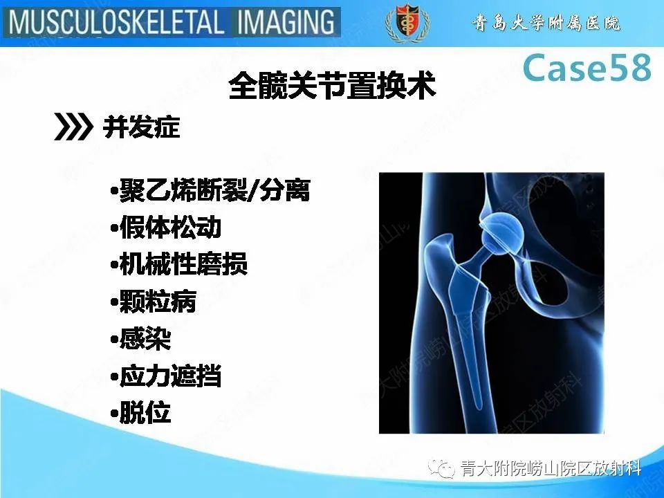 影像PPT - 【PPT】髋关节手术并发症-8