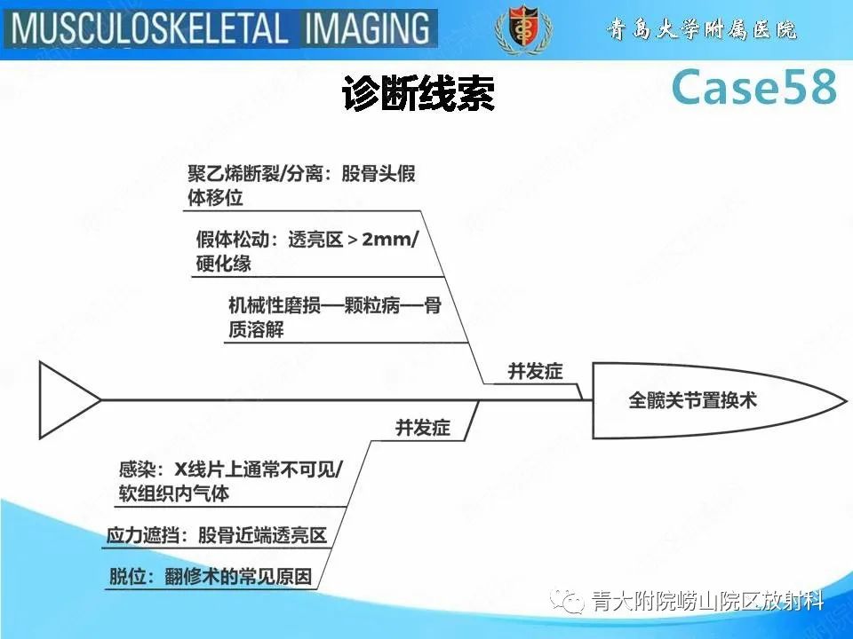 影像PPT - 【PPT】髋关节手术并发症-30