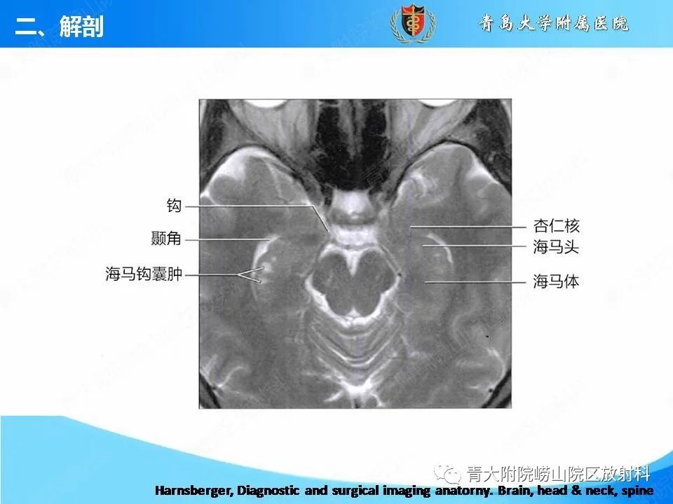 影像PPT - 【PPT】自身免疫性脑炎的影像诊断与鉴别-10