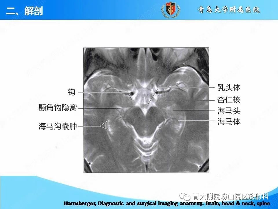 影像PPT - 【PPT】自身免疫性脑炎的影像诊断与鉴别-11