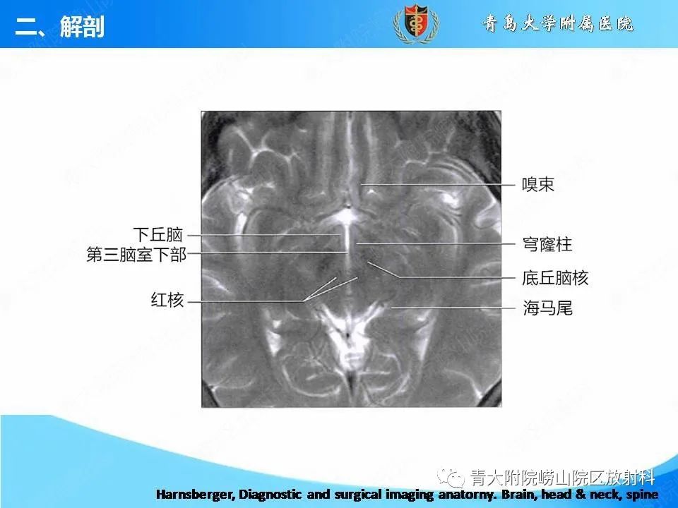 影像PPT - 【PPT】自身免疫性脑炎的影像诊断与鉴别-12