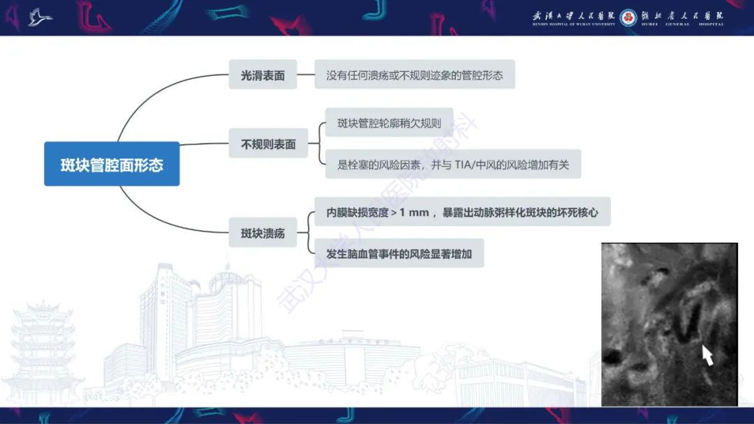 影像PPT - 【PPT】颈动脉斑块HR-MR影像判读-11