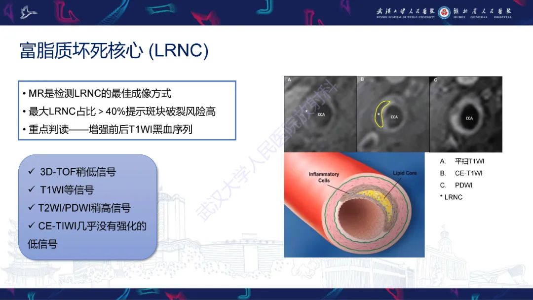 影像PPT - 【PPT】颈动脉斑块HR-MR影像判读-14