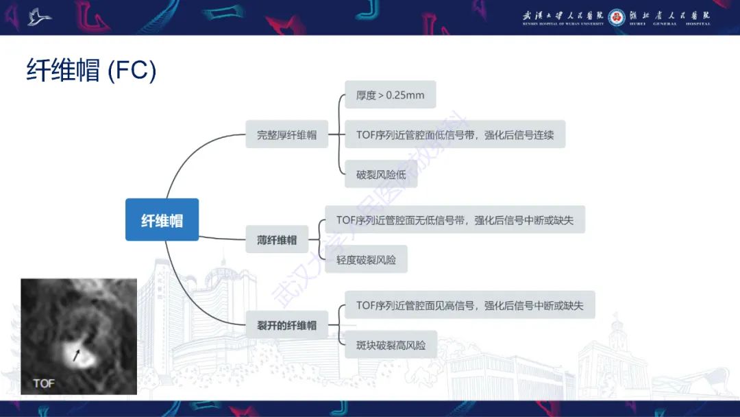 影像PPT - 【PPT】颈动脉斑块HR-MR影像判读-15