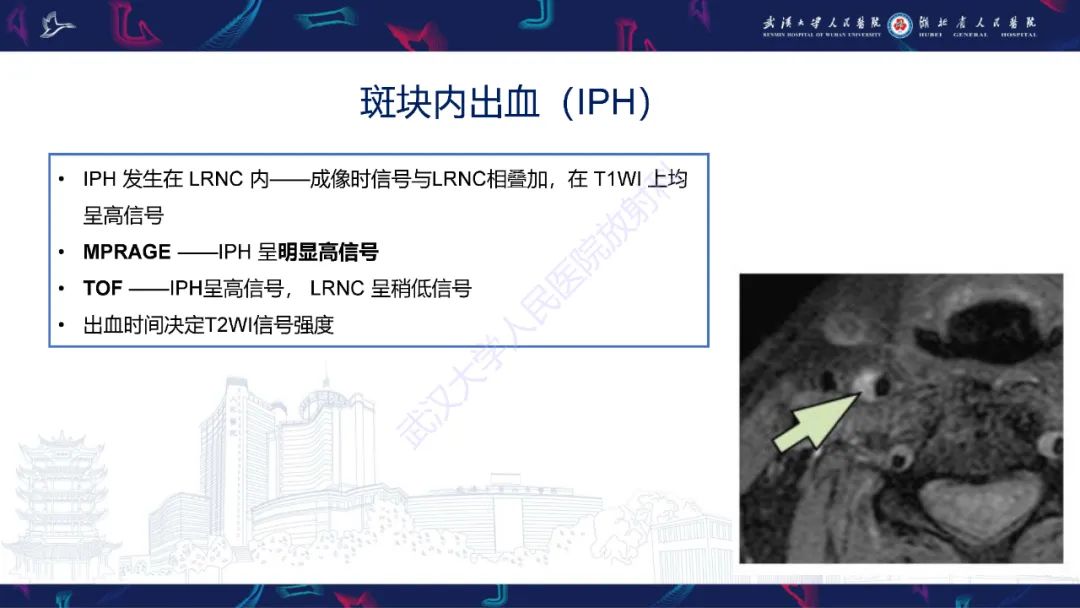 影像PPT - 【PPT】颈动脉斑块HR-MR影像判读-19