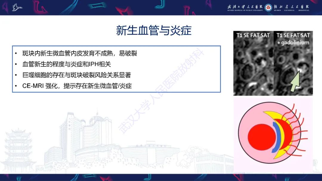 影像PPT - 【PPT】颈动脉斑块HR-MR影像判读-22