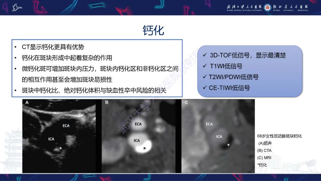 影像PPT - 【PPT】颈动脉斑块HR-MR影像判读-23