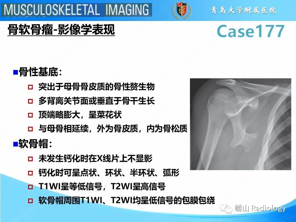 影像PPT - 【PPT】骨软骨瘤-恶变-7