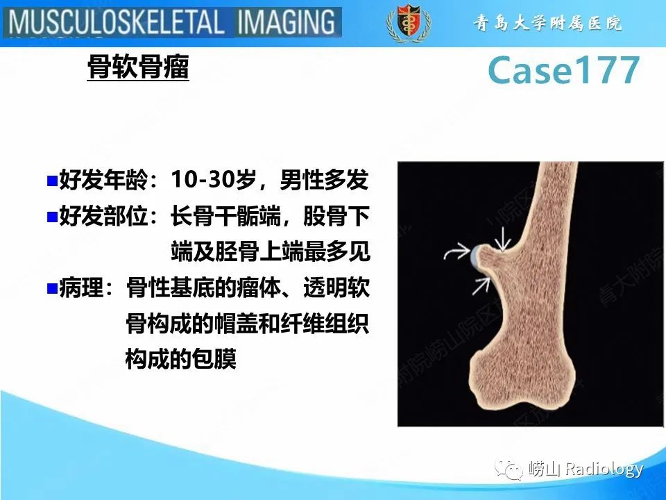 影像PPT - 【PPT】骨软骨瘤-恶变-6