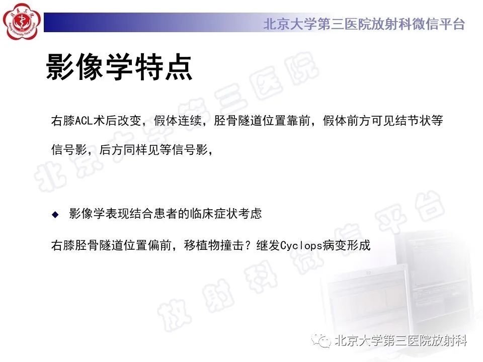 影像PPT - 【PPT】膝关节CYCLOPS病变-5