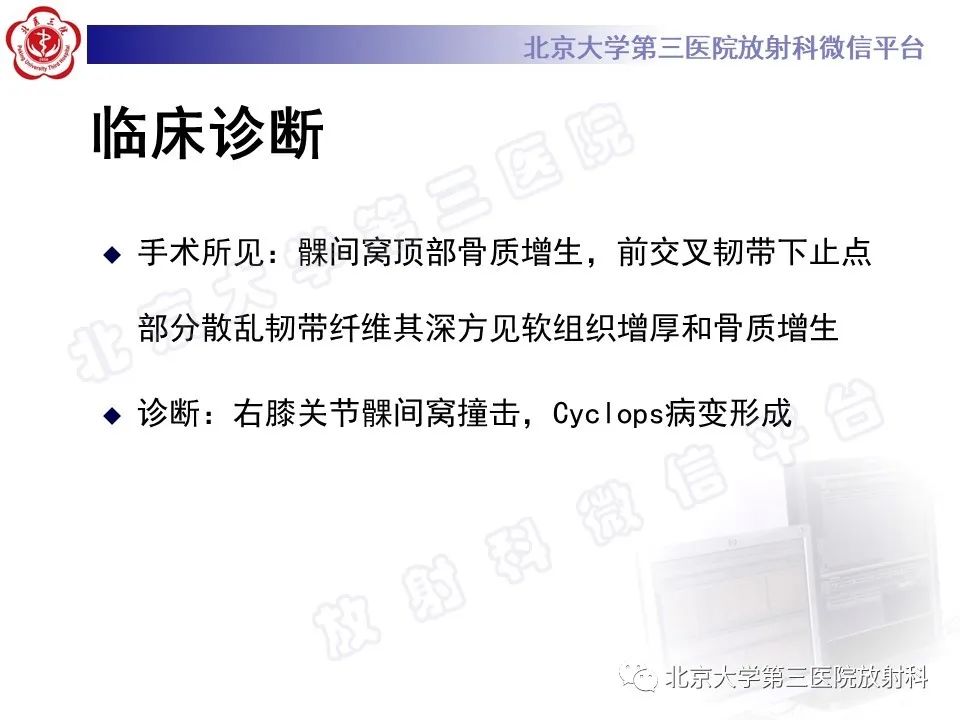 影像PPT - 【PPT】膝关节CYCLOPS病变-6
