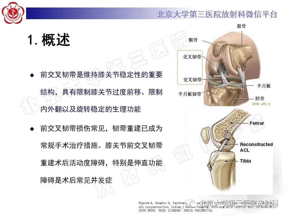 影像PPT - 【PPT】膝关节CYCLOPS病变-9