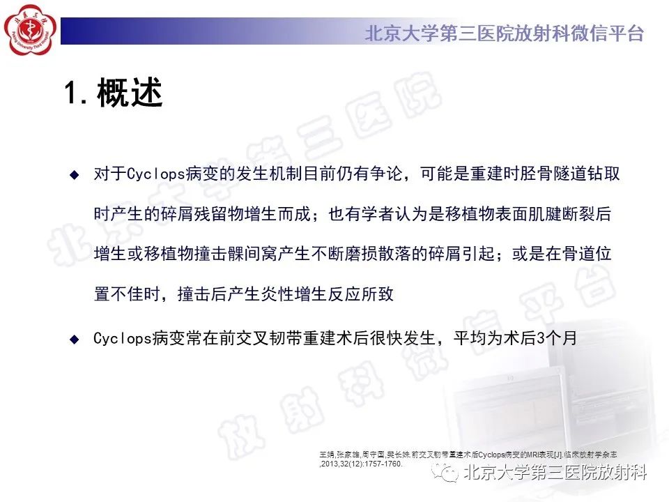 影像PPT - 【PPT】膝关节CYCLOPS病变-11