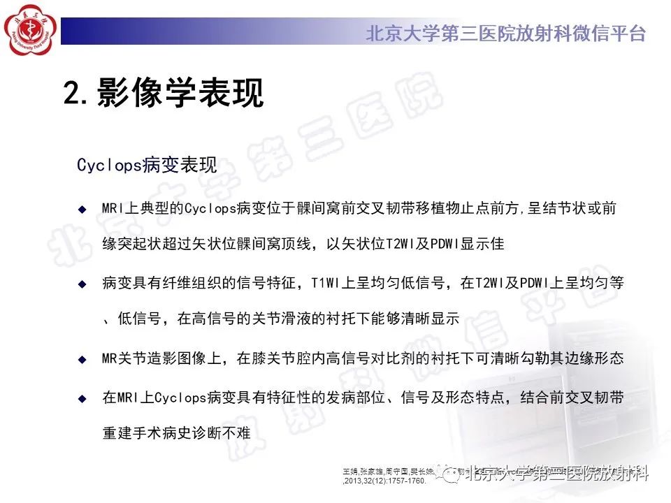 影像PPT - 【PPT】膝关节CYCLOPS病变-15
