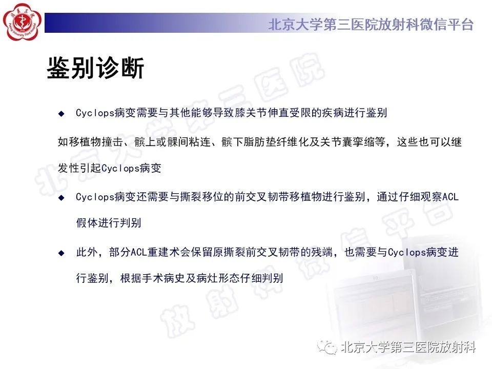 影像PPT - 【PPT】膝关节CYCLOPS病变-17