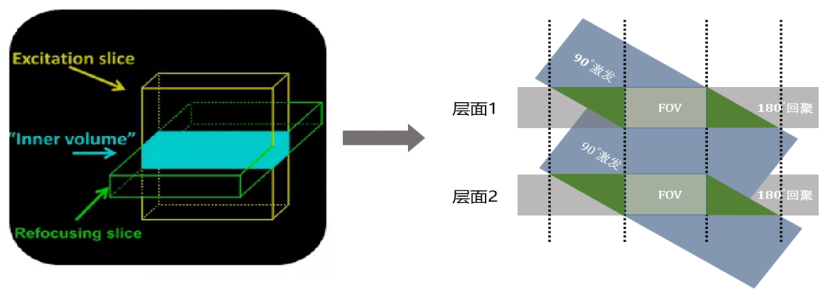 影像PPT - 微距扩散成像助力小视野靶向扫描-4
