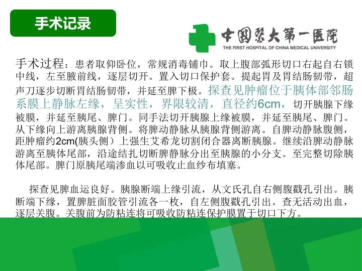 影像PPT - 【病例】胰腺实性假乳头状瘤1例CT及MR影像-8