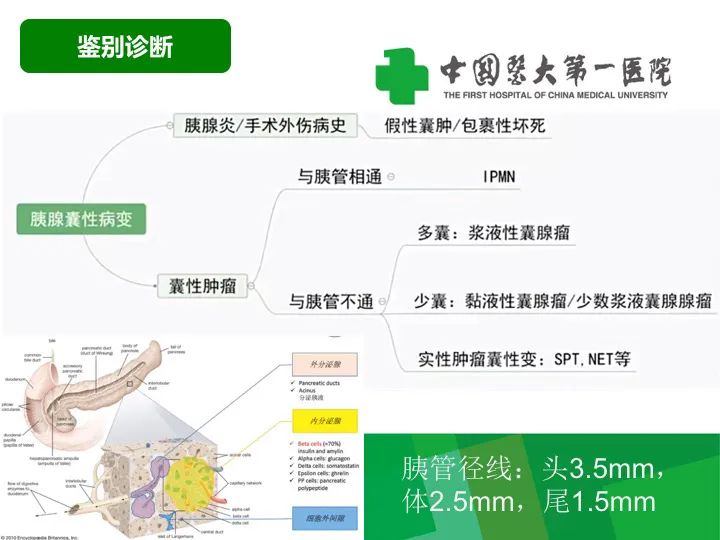 影像PPT - 【病例】胰腺实性假乳头状瘤1例CT及MR影像-18