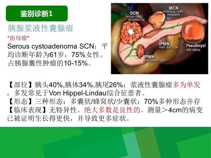 影像PPT - 【病例】胰腺实性假乳头状瘤1例CT及MR影像-21