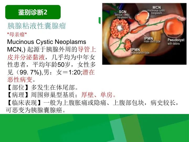 影像PPT - 【病例】胰腺实性假乳头状瘤1例CT及MR影像-28